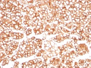 P Glycoprotein Recombinant Antibody / MDR1 / ABCB1 - image 1