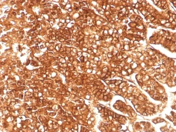 P Glycoprotein Recombinant Antibody / MDR1 / ABCB1 - image 1