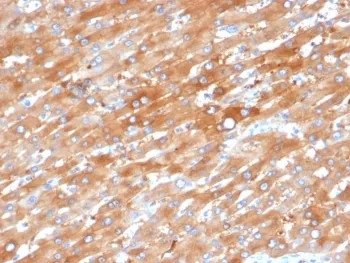 EPHB4 Antibody / EPH Receptor B4 - image 1