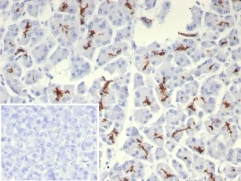 CFTR Recombinant Antibody / Cystic Fibrosis Transmembrane Regulator - image 1