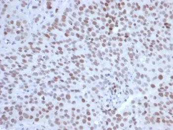 EZH2 Antibody - image 1
