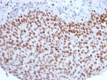 EZH2 Antibody - image 1