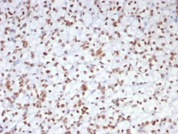 EZH2 Antibody - image 1