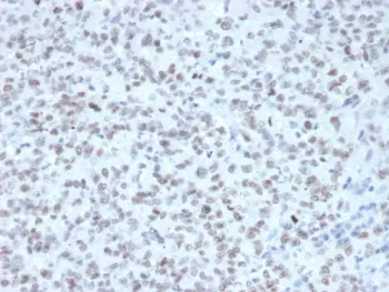 EZH2 Antibody - image 1