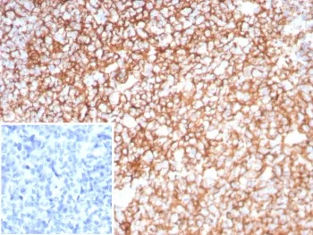 Clusterin Recombinant Antibody / Apolipoprotein J / APO-J - image 1