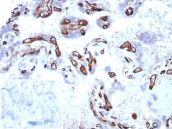 FABP4 Recombinant Antibody - image 1
