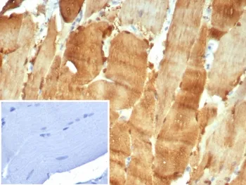 CA3 Antibody / Carbonic Anhydrase III - image 1