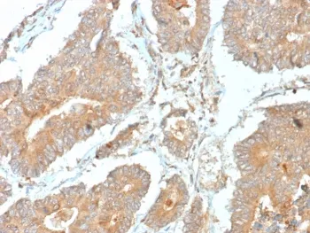 NECAB1 Antibody / N-terminal EF-hand calcium binding protein 1 - image 1