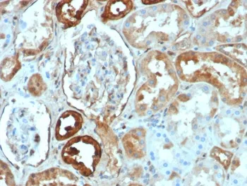 Calbindin Recombinant Antibody / CALB1 - image 1