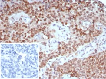 TRPS1 Recombinant Antibody / Tricho-rhino-phalangeal syndrome type I - image 1