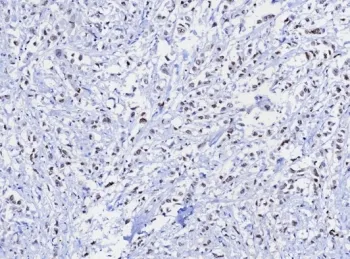 TRPS1 Recombinant Antibody / Tricho-rhino-phalangeal syndrome type I - image 1