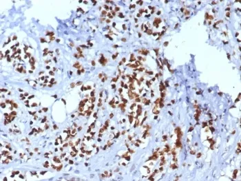 TRPS1 Recombinant Antibody / Tricho-rhino-phalangeal syndrome type I - image 1