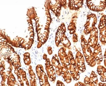 CA9 Antibody / Carbonic Anhydrase IX - image 1