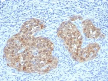 p16INK4a Recombinant Antibody / CDKN2A - image 1