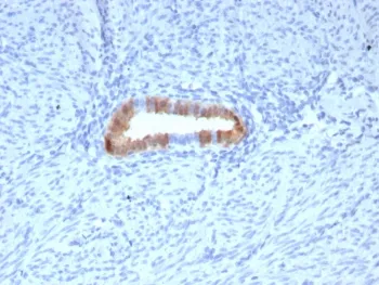 p16INK4a Recombinant Antibody / CDKN2A - image 1