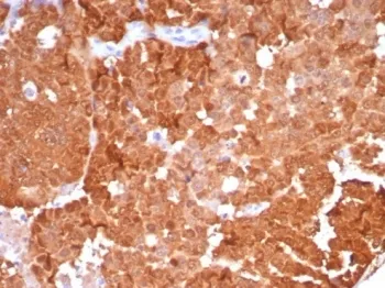 p16INK4a Recombinant Antibody / CDKN2A - image 1