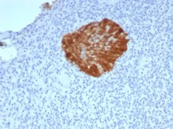 p16INK4a Recombinant Antibody / CDKN2A - image 1
