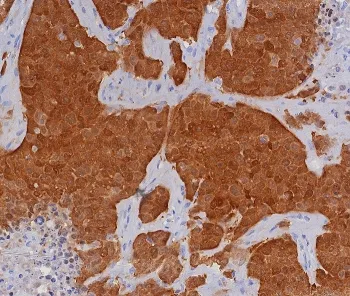 p16INK4a Recombinant Antibody / CDKN2A - image 1
