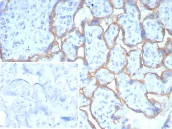 PD-L1 Recombinant Antibody / B7-H1 / CD274 - image 1