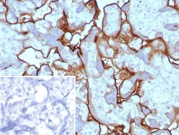 PD-L1 Recombinant Antibody / B7-H1 / CD274 - image 1