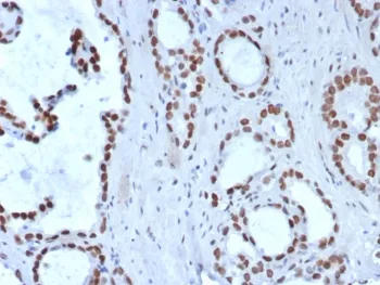 TLE1 Recombinant Antibody - image 1