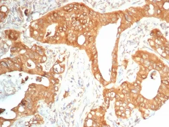 TrkB Antibody / NTRK2 - image 1