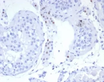 Steroidogenic Factor 1 Recombinant Antibody / SF-1 / NR5A1 - image 1