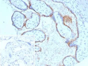 CD105 Recombinant Antibody / Endoglin - image 1