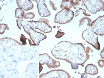CD105 Recombinant Antibody / Endoglin - image 1