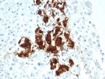 DBH Antibody / Dopamine beta Hydroxylase - image 1