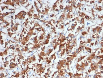 DBH Antibody / Dopamine beta Hydroxylase - image 1