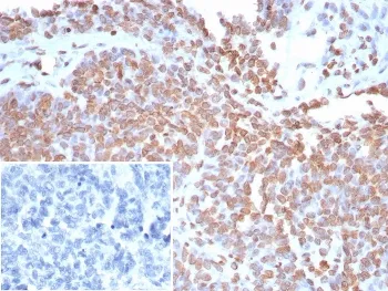 dsDNA Recombinant Antibody / Double Stranded DNA - image 1