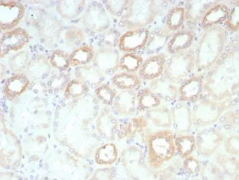 Biotin / Vitamin B7 / Vitamin H Recombinant Antibody - image 1