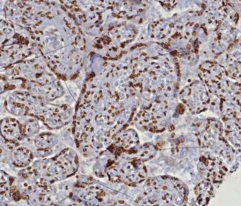 dsDNA Recombinant Antibody / Double Stranded DNA - image 1
