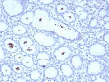 Helicobacter pylori Catalase Recombinant Antibody - image 1