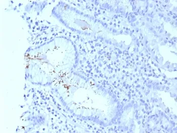 Helicobacter pylori Catalase Recombinant Antibody - image 1