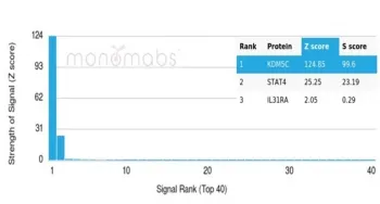 KDM5C Antibody / JARID1C / SMCX - image 1