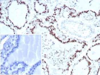 TFE3 Recombinant Antibody / Transcription factor E3 - image 1
