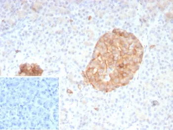 Synaptophysin Recombinant Antibody - image 1