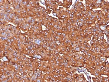 Synaptophysin Recombinant Antibody - image 1