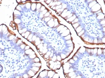 ACE2 Recombinant Antibody / Angiotensin-Converting Enzyme 2 - image 1