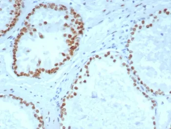 Androgen Receptor Recombinant Antibody - image 1