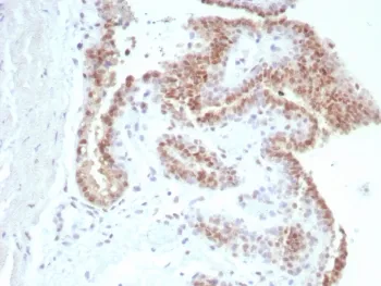 Androgen Receptor Recombinant Antibody - image 1