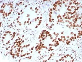 Androgen Receptor Recombinant Antibody - image 1
