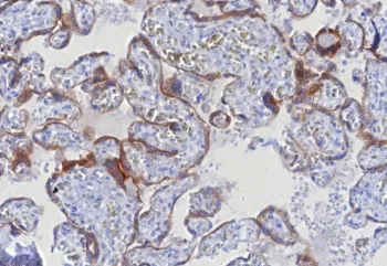 Glypican 3 Recombinant Antibody / GPC3 - image 1