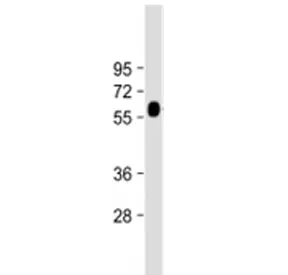 GGT3P Antibody (Center Region) - image 1