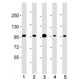 Beta Catenin Antibody (C-Terminal Region) - image 1