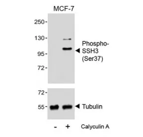 Phospho-SSH3 Antibody (Ser37) - image 1