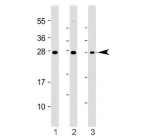 ST8SIA1 Antibody (N-Terminal Region) - image 1