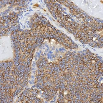 SGCE Antibody / Epsilon-sarcoglycan - image 1